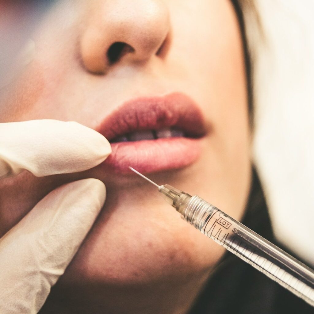 Aumento y perfilado de labios con resultados naturales en medicina estética