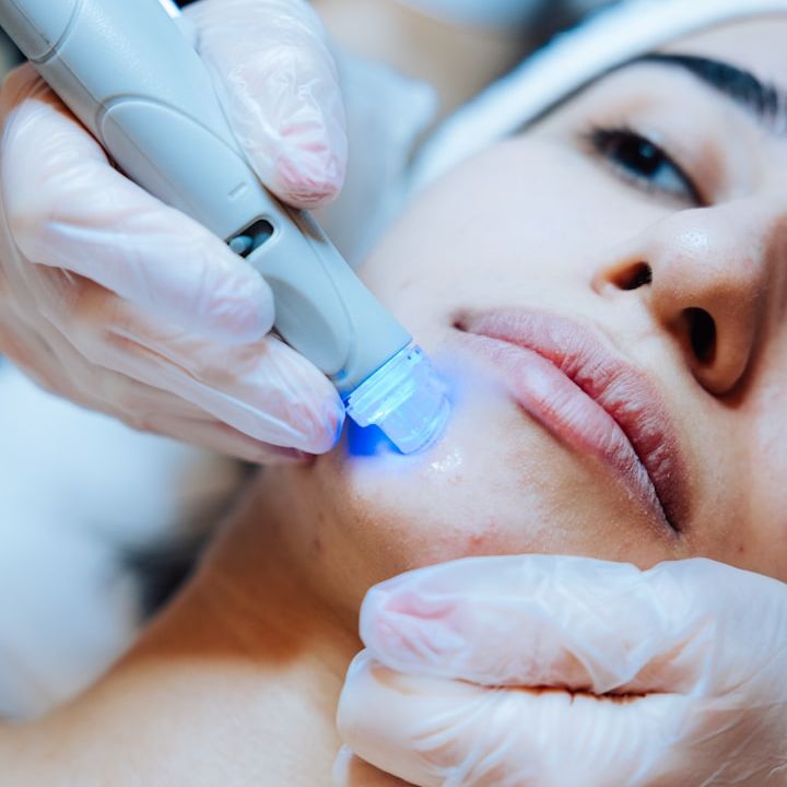 Resultados naturales en el rostro gracias a tratamientos estéticos personalizados